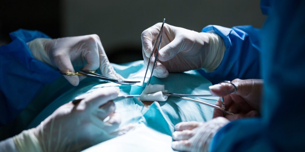 General Surgery